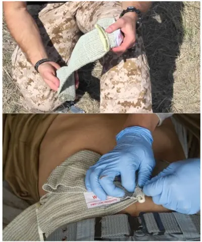 STOP BLEEDING BANDAGE